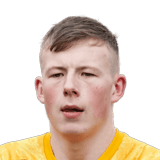 Anthony Patterson Face